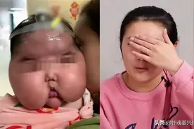 女宝宝一个月胖3斤，全身长汗毛！医生：当心这款黑心的宝宝霜图片