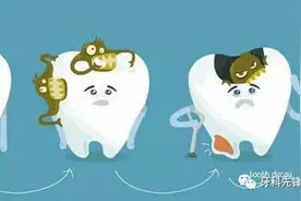 为什么有些牙齿不能拔？图片