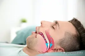 为何“打鼾”可能潜藏巨大健康风险？哪些睡眠迹象提示要看医生？图片
