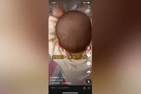 宝宝的头发多不多，黑不黑，和剃头没有关系，和这些有关系图片
