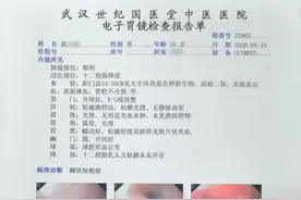 爱吃“烫食”，58岁大爷烫出食管癌图片