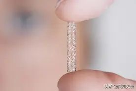 放在心脏里的支架到底长啥样？会老化吗？图片