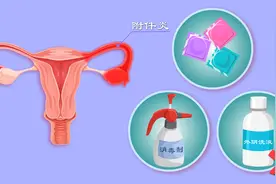 附件炎咋来的？性生活过频、人流惹的祸？硬核干货教你科学预防图片