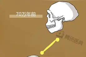 什么是智齿？为什么拔掉那么贵？图片