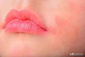 我看到你的脸上有块硬硬红红的东西图片