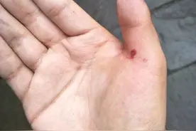 峨眉山的猴哥真是惹不起 太野性了 沈阳95后小伙喂食被偷袭 妥妥的12针代价图片