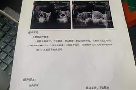 发现怀孕的过程真是满满的意外和惊喜，幸福来得太突然图片
