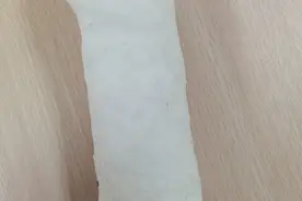 这个石膏管型，惊艳了骨科医生的眼图片