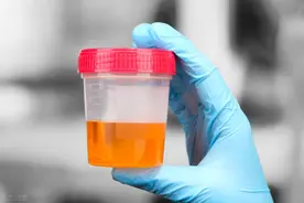 血尿以为是肾病，去了肾内科被推到泌尿外科！如何自我判断？图片