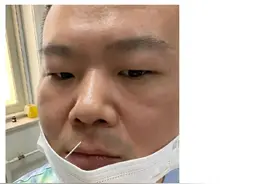 岳云鹏身体不适暂停营业，特地发文和粉丝报平安，刚刚针灸治腰疼图片