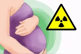 孕妇应聘未做胸透被拒录取：孕期辐射到底有没有这么可怕？图片