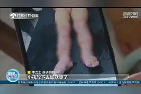 扬州2岁男童洗澡被烫 夏季幼儿烧烫伤频发，家长不得大意图片