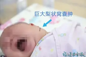 莆田一出生40天女婴脖子出现巨大肿物！出现这类情况，家长一定要提高警惕图片