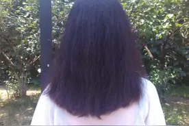 患者自述：“二十不惑”的年纪，我却与乳腺癌不期而遇……图片