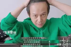 《向往的生活》：何炅秃顶了，回想三年前，真的是一语成谶图片