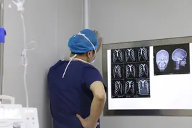 为什么整形手术前后不能吸烟？图片