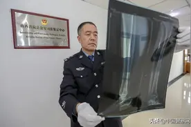 法医带着“造口袋”上岗，众人泪目图片
