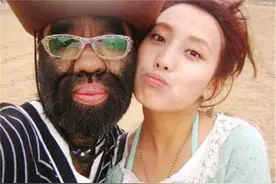 毛孩于震寰，出生就被研究，被女友母亲要求脱毛，42岁娶90后娇妻图片