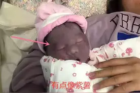 “紫薯宝宝”出生遭嫌弃，2个月后颜值逆袭，宝妈：还好当初没扔图片