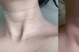女人脖子有“三条杠”，你知道代表什么意思吗？图片