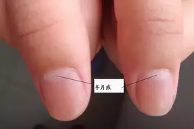 为什么有的人指甲上有月牙，有的人却没有？这才是科学的解释图片