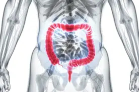 总感觉大便不畅、拉不干净？4种情况对号入座，排除肠癌的可能图片