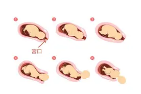 “开十指”才能顺产？带你了解开宫口的过程图片