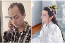 “秃顶网红”凭高颜值出圈，与真明星同框后，网友：滤镜碎了图片