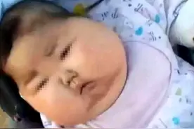 “巨婴”也遗传，秦海璐躲过高龄孕妈的危险，却躲不过遗传图片