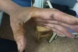 浙江一老伯田里干活遇眼镜蛇，打死后断掉的蛇头竟张开大口咬人！图片