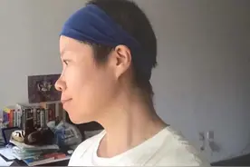 抗癌日记：中医师说我的短发好看，白头发也好看，我就收起头巾了图片