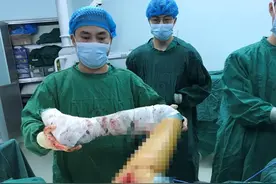北海一阿姨股骨头坏死 博士后为其成功置换图片
