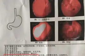 长期吃阿司匹林，四大副作用或找上你！要怎么吃？学到就是赚到图片
