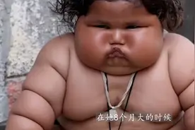 每小时就要吃一餐，那个1岁就重达45斤的女巨婴，6年过去怎么样了图片