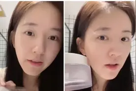 “笑眼甜心”赵露思自曝眼部神器，用30天就像做了一次热玛吉？图片