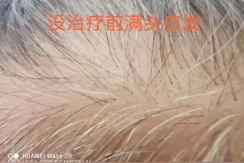 白发转黑美梦成真？图片