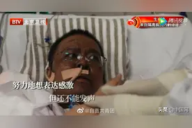 武汉两医生被ECMO救回后，脸部全变黑！专家释疑图片