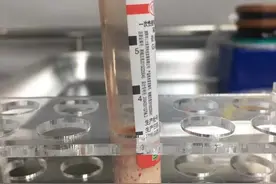 恐怖！22岁女老师每天一杯奶茶，午休时突然晕倒小便失禁，连血都是乳白色图片