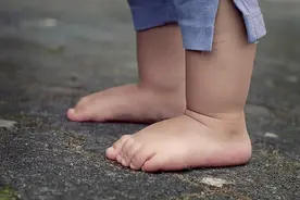 宝宝2岁前，腿伸不直正常吗？宝妈需警惕：学会1招识别3招矫正图片