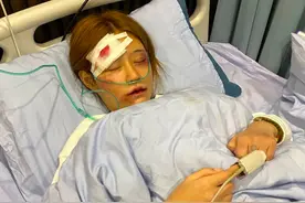 假的？戏精？百万网红王多鱼遭男友家暴住院，满身伤痕被质疑演戏图片