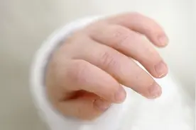妈妈们注意啦！宝宝指甲是健康的晴雨表图片