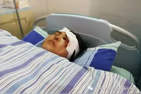 口罩惹的祸？广西一对夫妻戴口罩骑摩托车，妻子因一个细节失去左眼图片