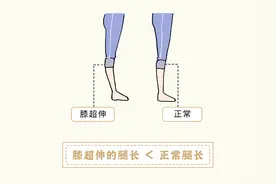 为啥有些女生的腿会变得越来越短？图片