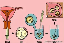 试管婴儿真的适合所有人吗？图片
