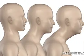 肌筋膜训练法图片