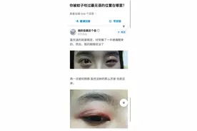 “你被蚊子咬过最无语的地方是哪里？”评论笑的肚子疼！图片