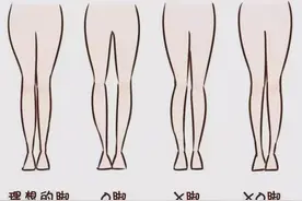 每天100次真的很累，一周后腿型变化惊人，看看你是什么腿型吧？图片