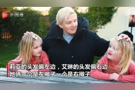 神奇又有趣的“镜像双胞胎”，虽长得一模一样，但行为却完全相反图片