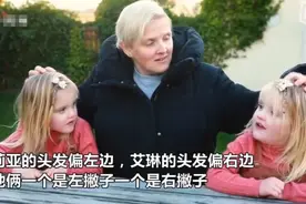 神奇又有趣的“镜像双胞胎”，虽长得一模一样，但行为却完全相反图片