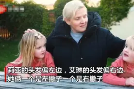 神奇又有趣的“镜像双胞胎”，虽长得一模一样，但行为却完全相反图片